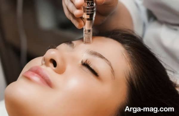  کاربرد دستگاه مزونیدلینگ
