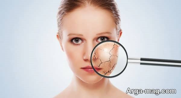 تاثیر خستگی بر پوست چقدر است؟ و چطور برطرف می شود؟