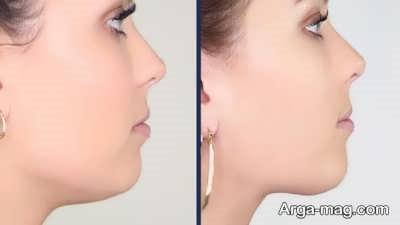 کاربرد های جراحی فک 