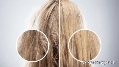 نحوه کارکرد پلکس تراپی