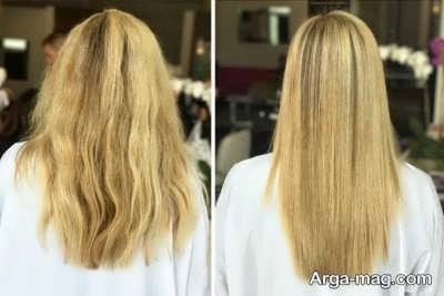 شماره های مختلف پلکس تراپی