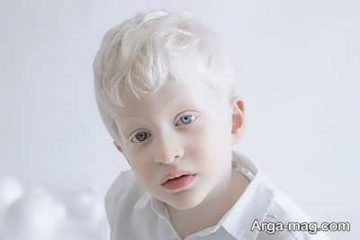 رنگ چشم افراد زال