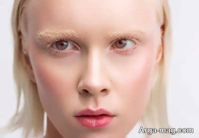 بینایی افراد زال