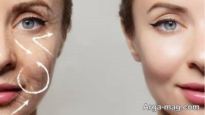 مکمل های غذایی هیالورونیک دار