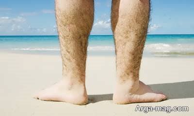 آلوپسی علت ریزش مو در بدن 