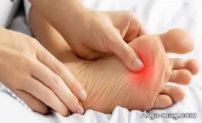 گرفتگی عروق پا چه نشانه هایی دارد و چطور درمان می شود؟