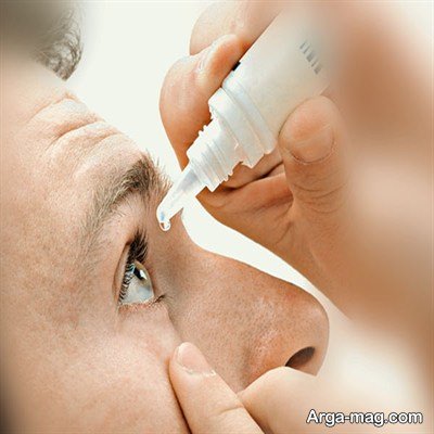 نحوه استفاده از قطره چشمی فلوکورت