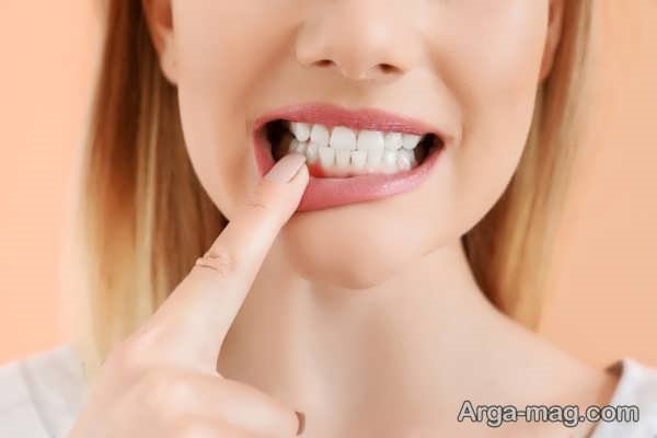 انواع آسیب ها و ناراحتی های لثه