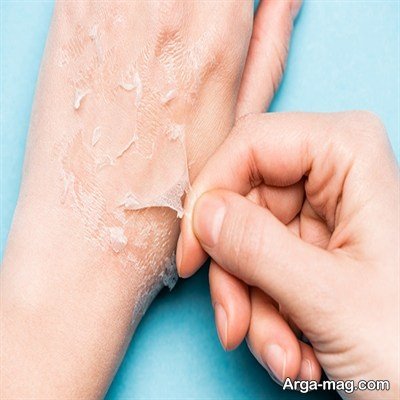 معرفی راه های رفع چروک دست