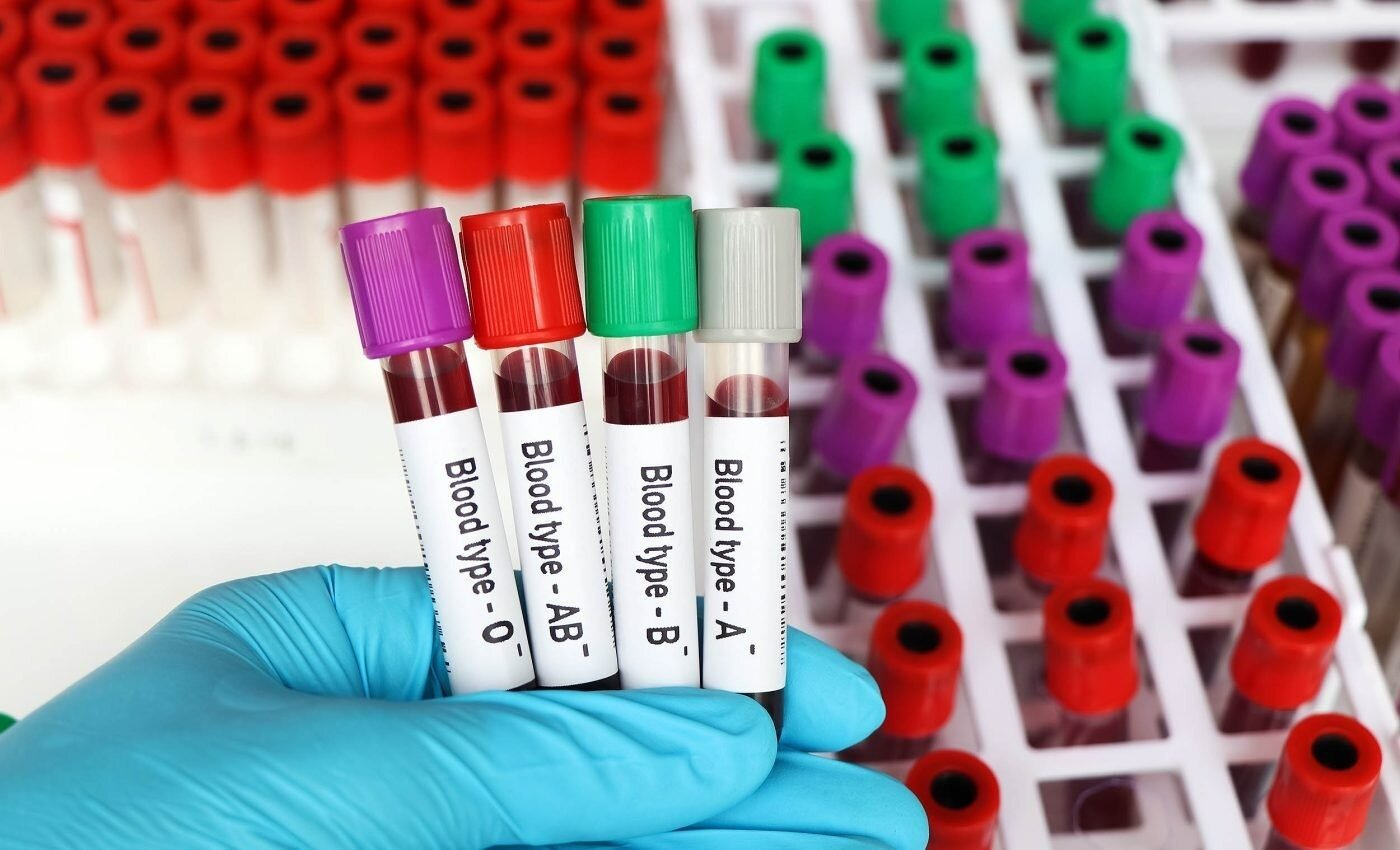 جنگل هیرکانی سوخت؛ مدیران مثل همیشه دیر رسیدند / 40 میلیون سال عمر دود شد و هوا رفت (فیلم)