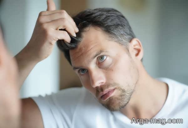 چرا موی بدن می ریزد؟ بررسی دلایل هورمونی، ژنتیکی و تغذیه ای