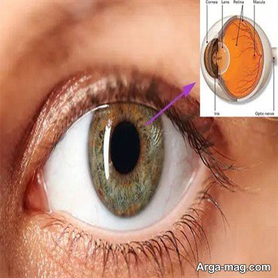 نازک شدن شبکیه چشم؛ علائم، علت ها و بهترین روش های درمان