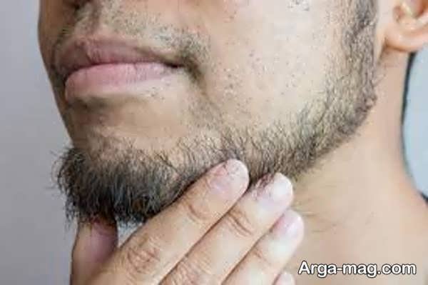 دیر ریش درآوردن