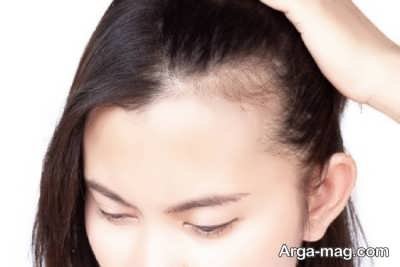 روتین موی کم پشت