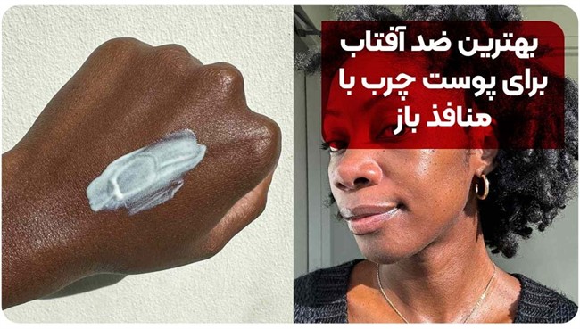 بهترین ضد آفتاب برای پوست چرب با منافذ باز