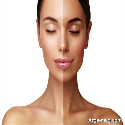 معرفی روش برنزه کردن پوست