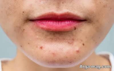 انواع جوش ها و نحوه ایجاد شدنشان 