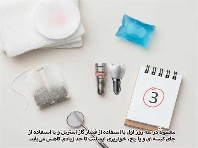 خونریزی ایمپلنت در سه روز اول و بعد از آن