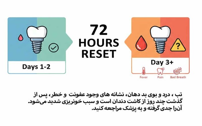 چه زمانی خونریزی ایمپلنت خطرناک است و بعد از ایمپلنت دندان چه زمانی باید به پزشک مراجعه کنیم