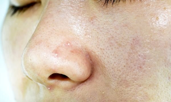 هیچ بینی‌‌ ایده‌آلی در جهان وجود ندارد