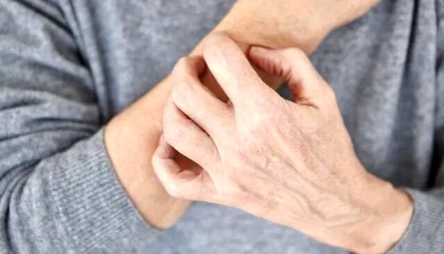 هشدار/ این علائم بر روی پوستتان، خبر از بیماری می دهد