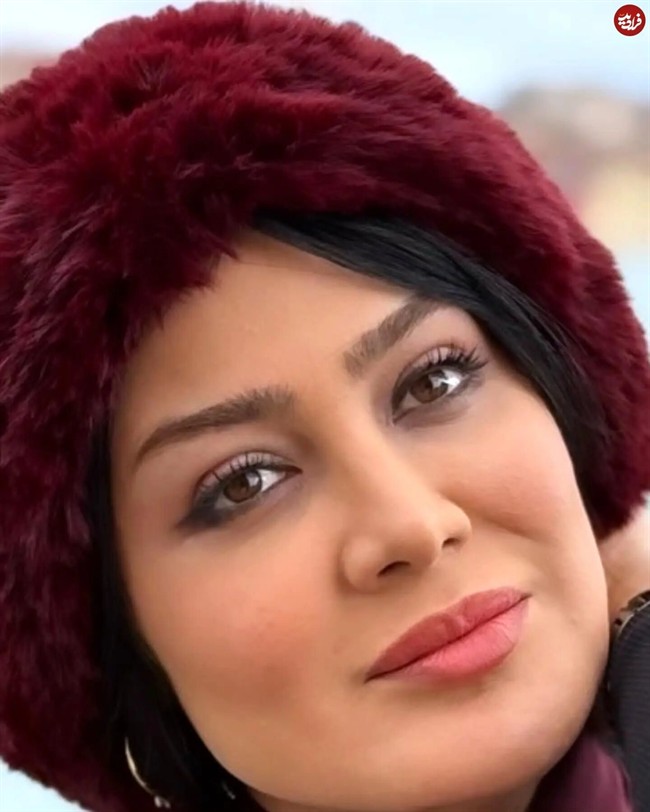 11zon_dr.zahra_jahromi_1743532115_3601330864279001897_4637168261