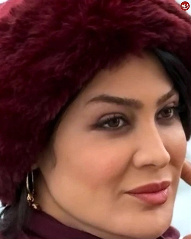 11zon_dr.zahra_jahromi_1743532115_3601330864606332668_4637168261