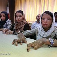 آخرین وضعیت درمانی کودکان شینآبادی