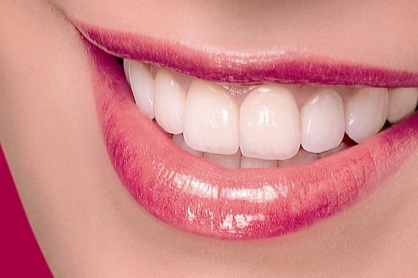 teeth-whitening