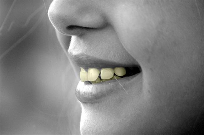 زرد شدن دندان ها