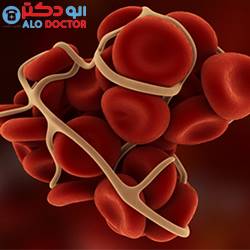 متهمان اصلی بروز لختگی خون: گوشت و تخم مرغ!