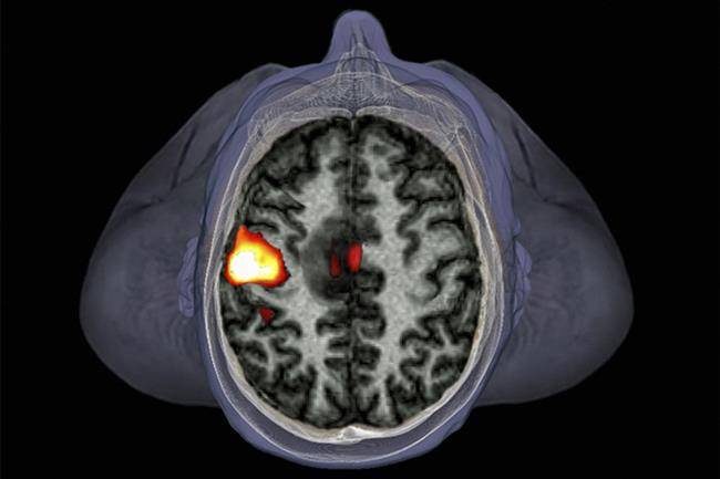 fmri