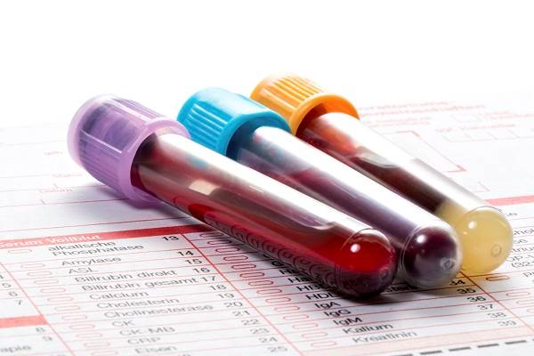 مشکلات سلامت که با آزمایش خون آشکار می‌شوند