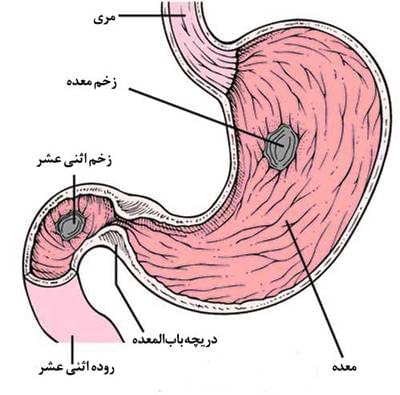 بهار فصل گل کردن زخم اثنی عشر