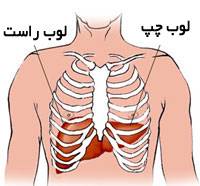 چگونه از کبد خود مراقبت کنیم؟