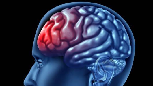علایم آسیب (ضربه) مغزی: علایم آسیب مغزی میتواند آنی بوده، و یا پس از ساعت ها و یا روزها خود را بروز دهند.