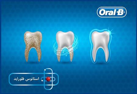 آسیب‌های دندان از آن‌چه فکر می‌کنید به شما نزدیک‌تر است!