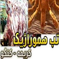 مرگ زن 19 ساله مشکوک به تب کریمه گنگو در بیمارستان نمازی شیراز