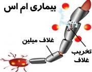 همسر آتنه فقیه نصیری علایم ام اس درمان ام اس پیشگیری از ام اس بیوگرفی آتنه فقیه نصیری بیماری بازیگران