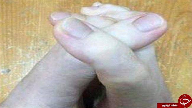 دختر تایوانی بلندترین انگشتان پا در جهان را دارد +تصاویر