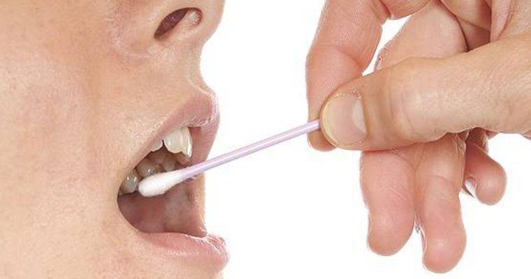آیا از خواص درمانی بزاق دهان با خبر هستید؟