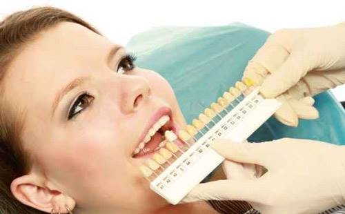 ایمپلنت؛ مطلوب ترین جایگزین دندان های از دست رفته