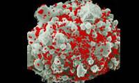 اثر ویروس HIV و سایر عفونتها بر پری ناتال