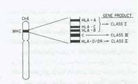 اختلالات ایمنی Rh در حاملگی(1)