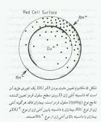 اختلالات ایمنی Rh در حاملگی(1)