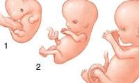 سقط مکرر جنین؛ چرا و به چه علت؟