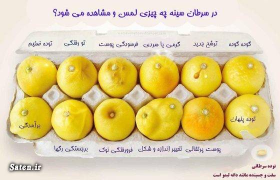 مجله پزشکی علایم سرطان سینه در دختران علائم سرطان پستان سن سرطان سینه سرطان سینه سرطان پستان بیوگرافی مریم میرزاخانی بیماری مریم میرزاخانی آیا سرطان سینه کشنده است