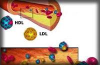 کلسترول بالا، خداحافظ!