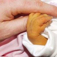 5 راهکار طب سنتی برای درمان «زردی نوزادان»