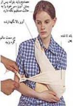 کمکهای اولیه شکستگی استخوان ترقوه